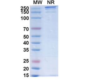SDS-PAGE - SGN-B7H4V Biosimilar - Anti-B7-H4 Antibody - BSA and Azide free (A339880) - Antibodies.com
