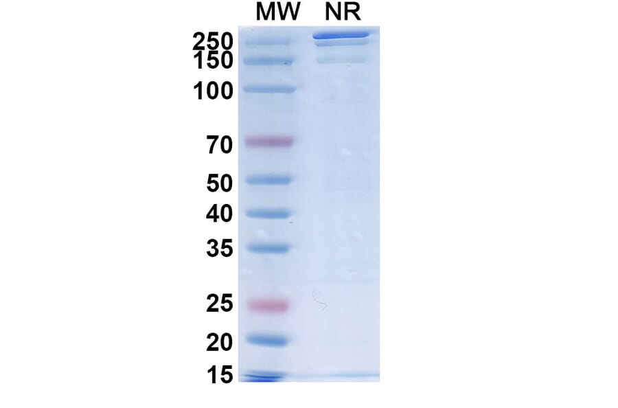 SDS-PAGE - SGN-B7H4V Biosimilar - Anti-B7-H4 Antibody - BSA and Azide free (A339880) - Antibodies.com