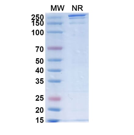 SDS-PAGE - SGN-B7H4V Biosimilar - Anti-B7-H4 Antibody - BSA and Azide free (A339880) - Antibodies.com