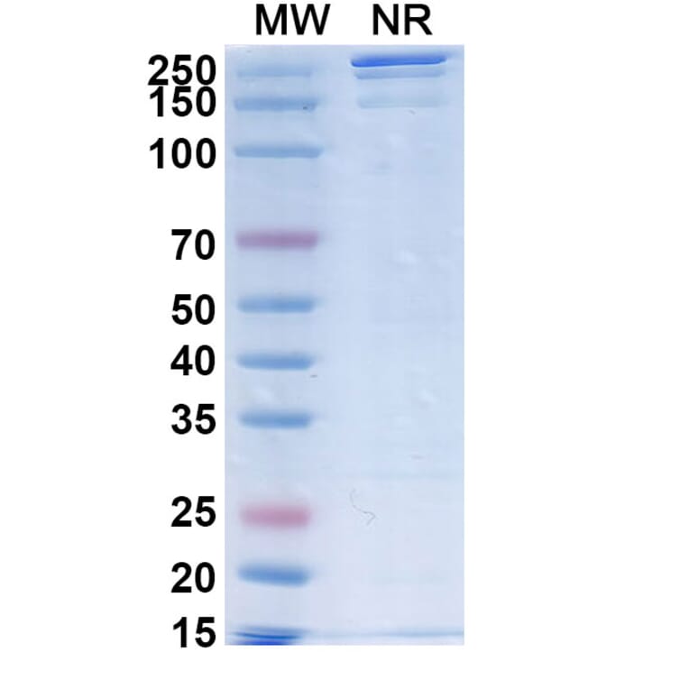 SDS-PAGE - SGN-B7H4V Biosimilar - Anti-B7-H4 Antibody - BSA and Azide free (A339880) - Antibodies.com