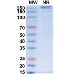 SDS-PAGE - SGN-B7H4V Biosimilar - Anti-B7-H4 Antibody - BSA and Azide free (A339880) - Antibodies.com