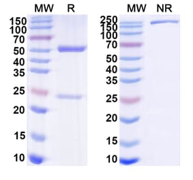 SDS-PAGE - Arevirumab-3 Biosimilar - Anti-GPC Antibody - BSA and Azide free (A339884) - Antibodies.com