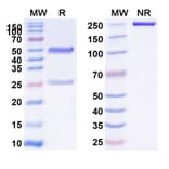 SDS-PAGE - Anti-Glypican 3 Antibody [Hu9F2] Biosimilar - BSA and Azide free (A339887) - Antibodies.com