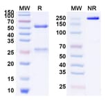SDS-PAGE - Anti-SARS-CoV-2 Spike Protein Glycoprotein 2 Antibody [HCLC-31] Biosimilar - BSA and Azide free (A339891) - Antibodies.com