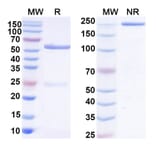 SDS-PAGE - Anti-SARS-CoV-2 Spike Protein Glycoprotein 2 Antibody [WS6] Biosimilar - BSA and Azide free (A339893) - Antibodies.com