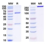 SDS-PAGE - Anti-Glypican 3 Antibody [CYT-33] Biosimilar - BSA and Azide free (A339911) - Antibodies.com