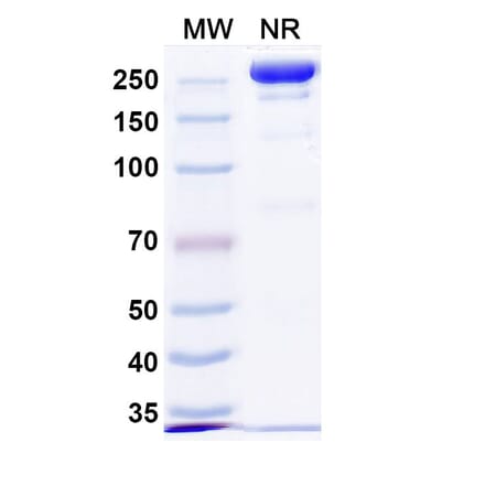 SDS-PAGE - Anti-Repulsive Guidance Molecule C Antibody [DISC-974] Biosimilar - BSA and Azide free (A339921) - Antibodies.com