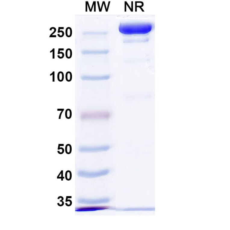 SDS-PAGE - Anti-Repulsive Guidance Molecule C Antibody [DISC-974] Biosimilar - BSA and Azide free (A339921) - Antibodies.com