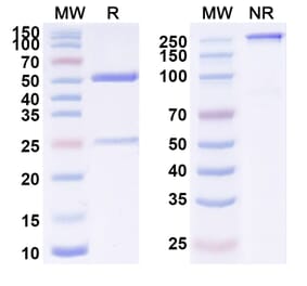 SDS-PAGE - Anti-ErbB2 Antibody [BSI-1] Biosimilar - BSA and Azide free (A339934) - Antibodies.com