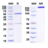 SDS-PAGE - Anti-ErbB2 Antibody [BAT16] Biosimilar - BSA and Azide free (A339935) - Antibodies.com