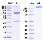 SDS-PAGE - Anti-ErbB2 Antibody [FS12] Biosimilar - BSA and Azide free (A339945) - Antibodies.com