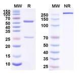 SDS-PAGE - Anti-ErbB2 Antibody [GB251] Biosimilar - BSA and Azide free (A339948) - Antibodies.com