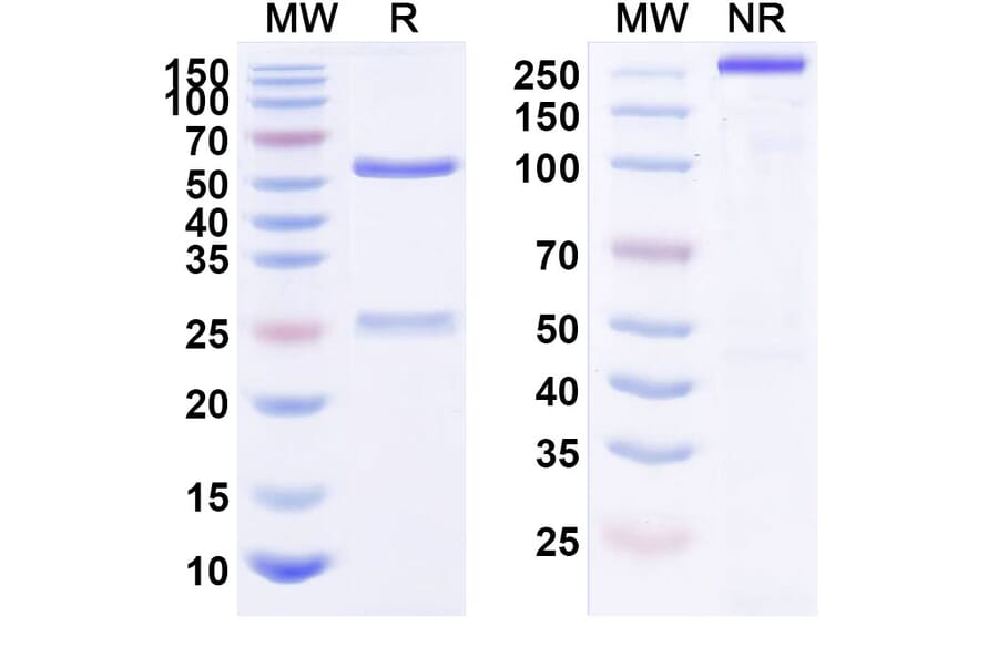 SDS-PAGE - Anti-ErbB2 Antibody [KL-A166] Biosimilar - BSA and Azide free (A339956) - Antibodies.com