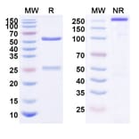 SDS-PAGE - Anti-ErbB2 Antibody [KL-A166] Biosimilar - BSA and Azide free (A339956) - Antibodies.com