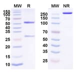 SDS-PAGE - Anti-ErbB2 Antibody [PF-6888667] Biosimilar - BSA and Azide free (A339965) - Antibodies.com