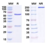 SDS-PAGE - Anti-ErbB3 Antibody [AV-23] Biosimilar - BSA and Azide free (A339975) - Antibodies.com