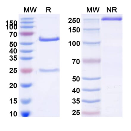 SDS-PAGE - Anti-ErbB3 Antibody [MP-RM-1] Biosimilar - BSA and Azide free (A339979) - Antibodies.com