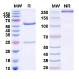 SDS-PAGE - Anti-ErbB3 Antibody [MP-RM-1] Biosimilar - BSA and Azide free (A339979) - Antibodies.com