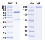 SDS-PAGE - Anti-IFN gamma Antibody [AMG 811] Biosimilar - BSA and Azide free (A339995) - Antibodies.com