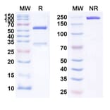 SDS-PAGE - Anti-IgE Antibody [SYN8] Biosimilar - BSA and Azide free (A339999) - Antibodies.com