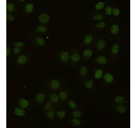 Immunocytochemistry - PCNA Monoclonal Antibody from Signalway Antibody (27210) - Antibodies.com