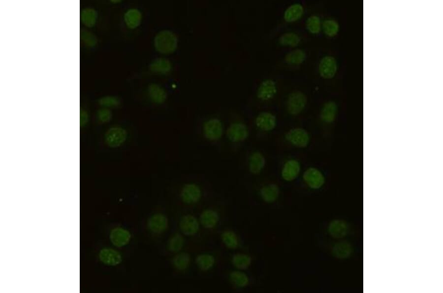 Immunocytochemistry - PCNA Monoclonal Antibody from Signalway Antibody (27210) - Antibodies.com