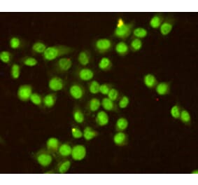 Immunocytochemistry - RPA32/RPA2 Monoclonal Antibody from Signalway Antibody (27216) - Antibodies.com