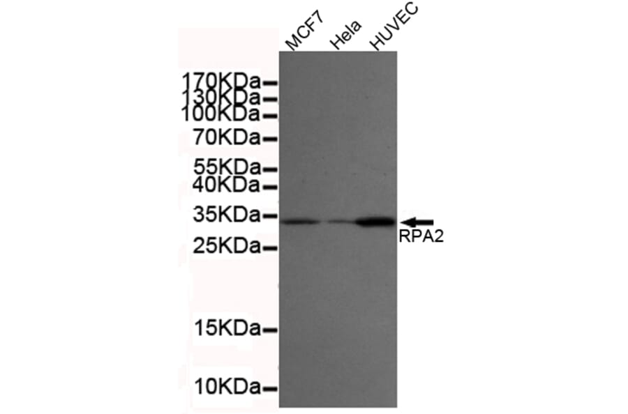 Western blot - RPA32/RPA2 Monoclonal Antibody from Signalway Antibody (27216) - Antibodies.com