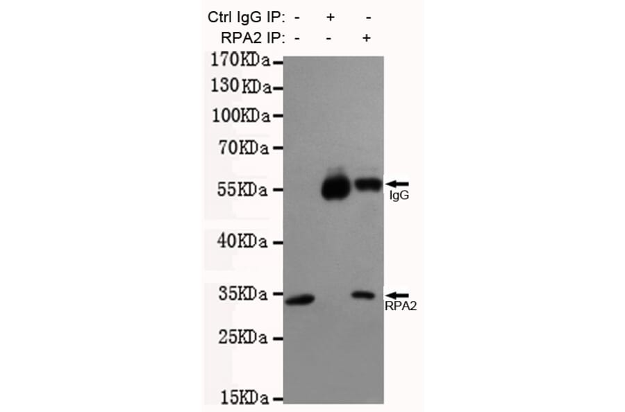 Immunoprecipitation - RPA32/RPA2 Monoclonal Antibody from Signalway Antibody (27216) - Antibodies.com