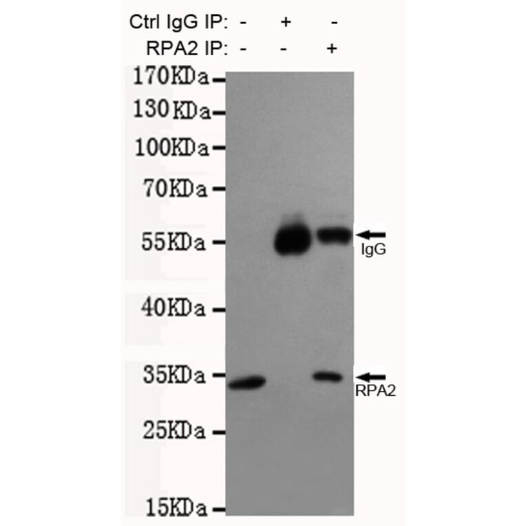 Immunoprecipitation - RPA32/RPA2 Monoclonal Antibody from Signalway Antibody (27216) - Antibodies.com