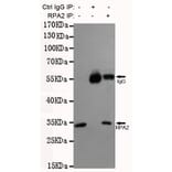 Immunoprecipitation - RPA32/RPA2 Monoclonal Antibody from Signalway Antibody (27216) - Antibodies.com