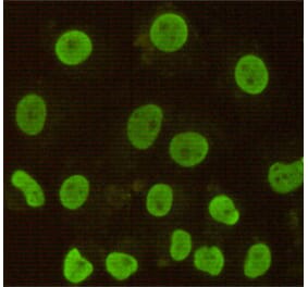 Immunocytochemistry - CDX2 Monoclonal Antibody from Signalway Antibody (27189) - Antibodies.com