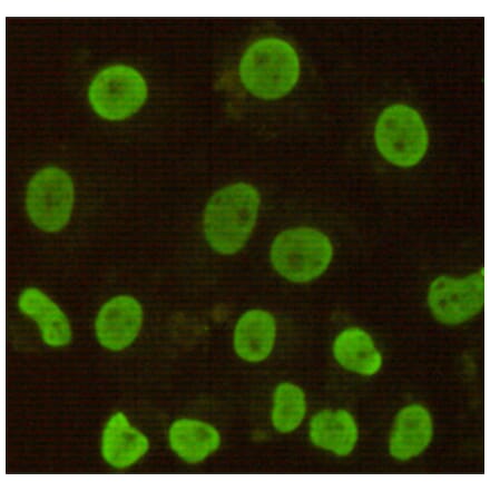 Immunocytochemistry - CDX2 Monoclonal Antibody from Signalway Antibody (27189) - Antibodies.com