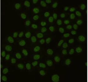 Immunocytochemistry - PCNA Monoclonal Antibody from Signalway Antibody (27211) - Antibodies.com