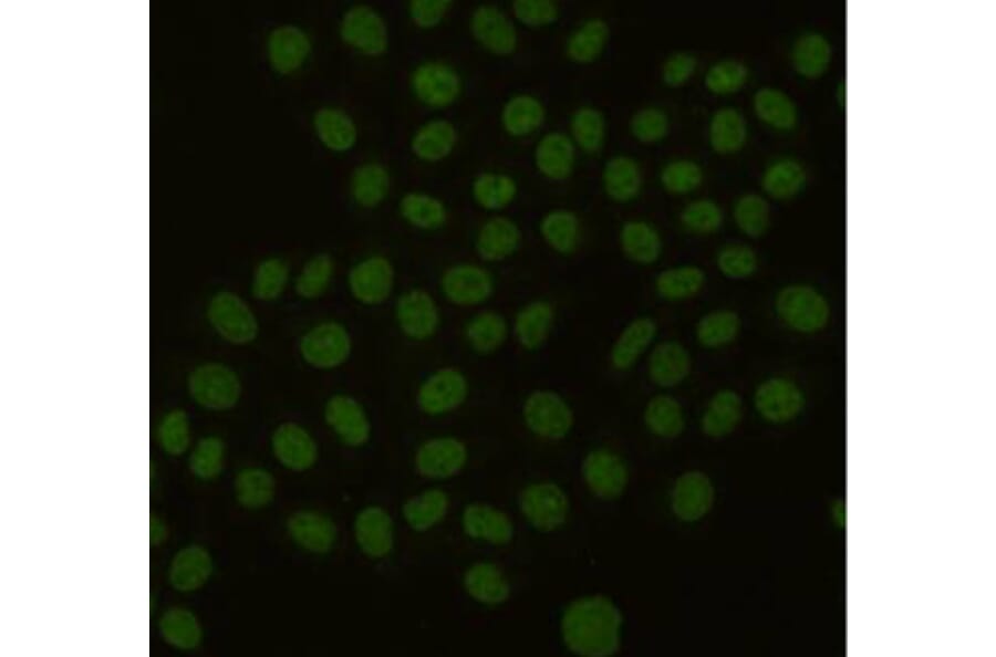 Immunocytochemistry - PCNA Monoclonal Antibody from Signalway Antibody (27211) - Antibodies.com