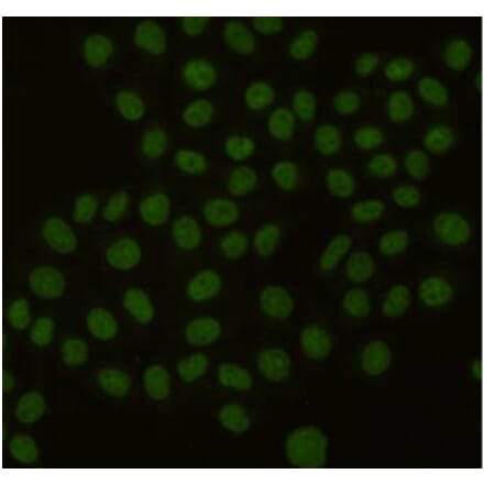 Immunocytochemistry - PCNA Monoclonal Antibody from Signalway Antibody (27211) - Antibodies.com