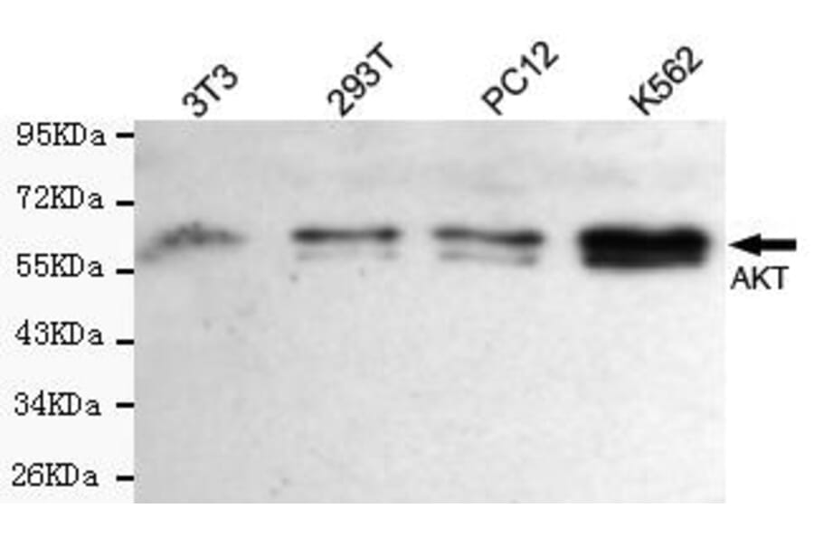 Western blot - total AKT Monoclonal Antibody from Signalway Antibody (27174) - Antibodies.com