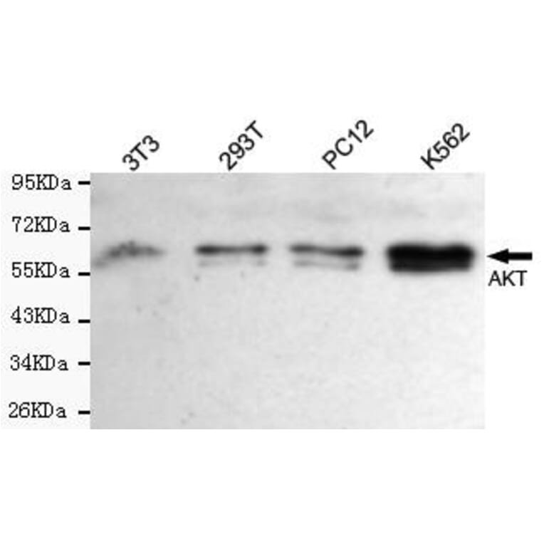 Western blot - total AKT Monoclonal Antibody from Signalway Antibody (27174) - Antibodies.com