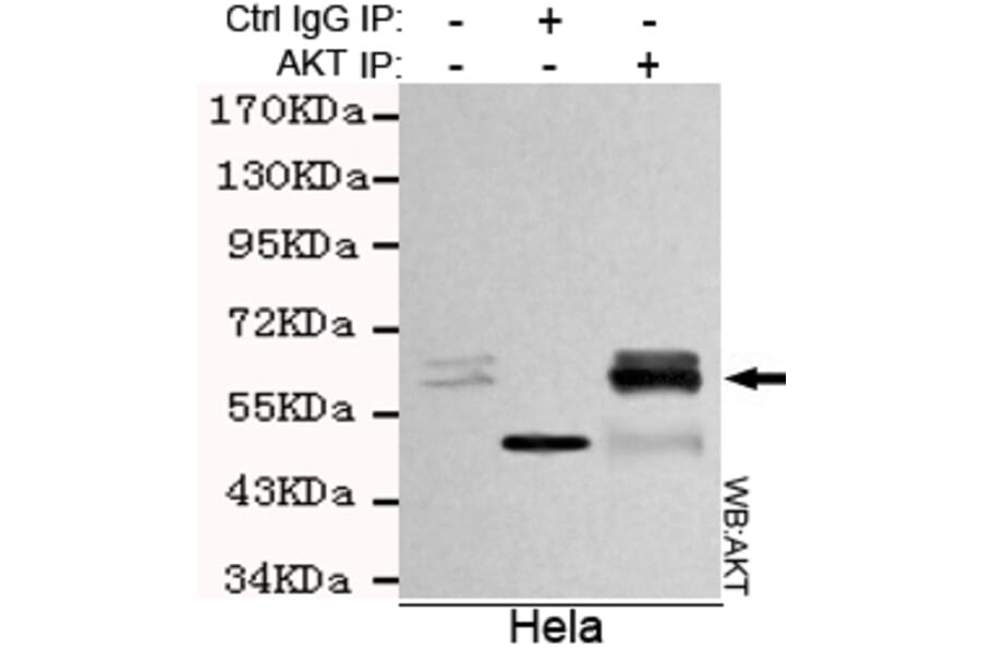Immunoprecipitation - total AKT Monoclonal Antibody from Signalway Antibody (27174) - Antibodies.com