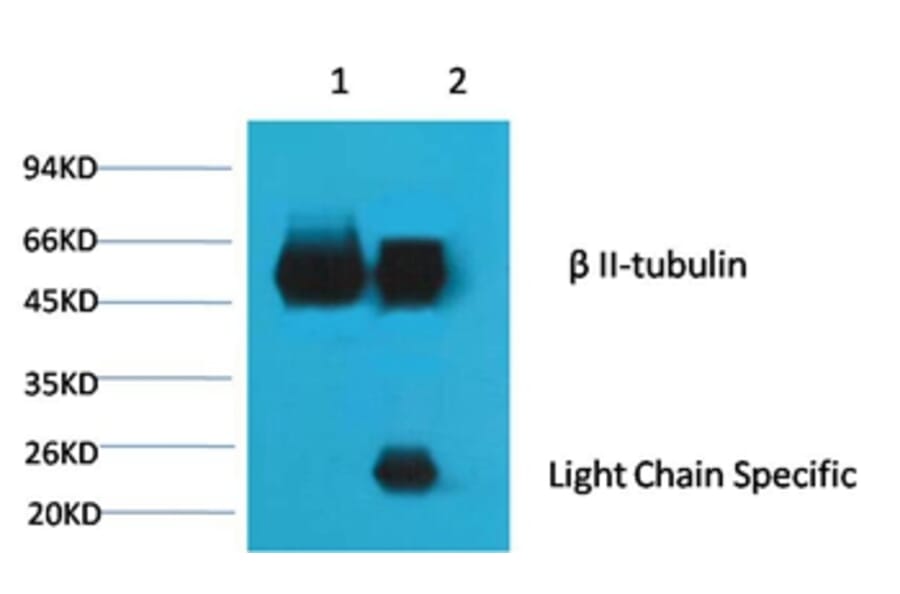 β II tubulin Mouse Monoclonal Antibody (Rodent Preferred) from Signalway Antibody (38092) - Antibodies.com