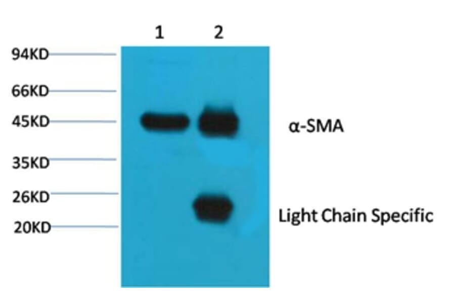 α Skeletal Muslce Actin Mouse Monoclonal Antibody (4B11) from Signalway Antibody (38090) - Antibodies.com