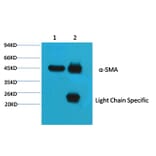 α Skeletal Muslce Actin Mouse Monoclonal Antibody (4B11) from Signalway Antibody (38090) - Antibodies.com
