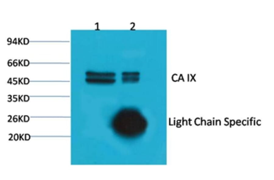 Carbonic Anhydrase IX Mouse Monoclonal Antibody from Signalway Antibody (38033) - Antibodies.com