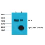 Carbonic Anhydrase IX Mouse Monoclonal Antibody from Signalway Antibody (38033) - Antibodies.com