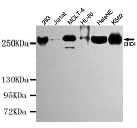 Western blot - CHD4 Monoclonal Antibody from Signalway Antibody (27196) - Antibodies.com