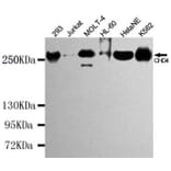 Western blot - CHD4 Monoclonal Antibody from Signalway Antibody (27196) - Antibodies.com