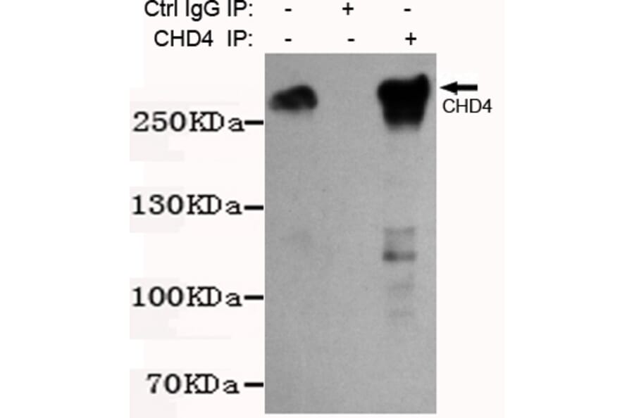 Immunoprecipitation - CHD4 Monoclonal Antibody from Signalway Antibody (27196) - Antibodies.com