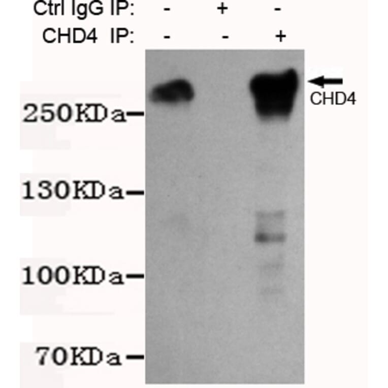 Immunoprecipitation - CHD4 Monoclonal Antibody from Signalway Antibody (27196) - Antibodies.com