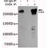 Immunoprecipitation - CHD4 Monoclonal Antibody from Signalway Antibody (27196) - Antibodies.com