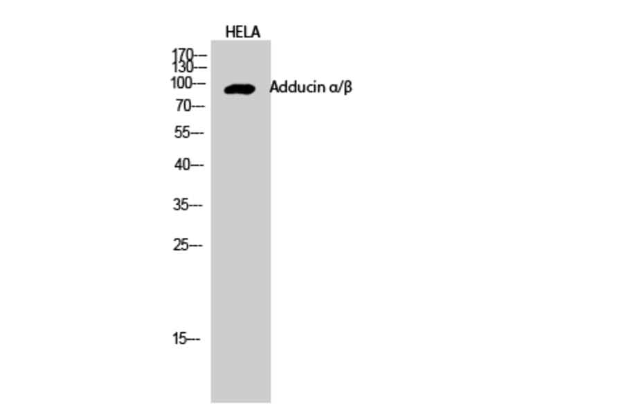 Western blot - Adducin α/β Polyclonal Antibody from Signalway Antibody (40554) - Antibodies.com